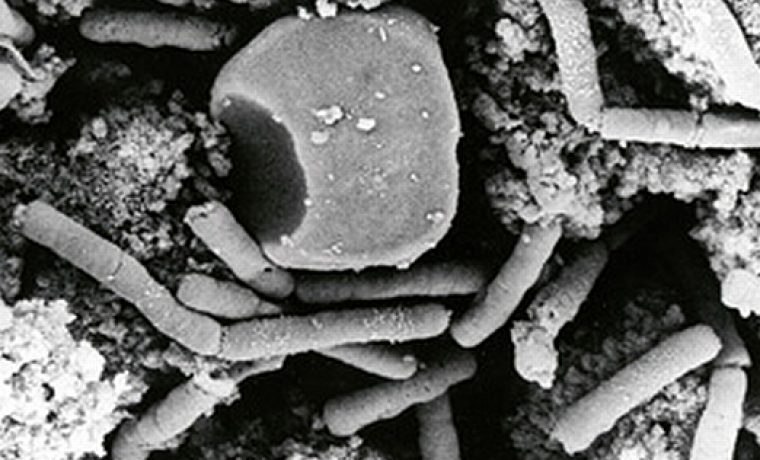 AnthraxBacteria_wiki_1264327386.jpg Foto: Index.hr