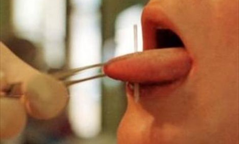 bodypiercing12308_ned_thumb_thumb_1271591261.jpg Foto: Slobodna Dalmacija