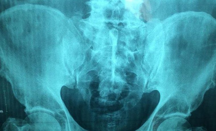 doctor_1297054_1920_1483474509.jpg Foto: Pixabay.com