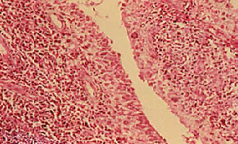 golimumab_1319628486.jpg golimumab_1319628486.jpg